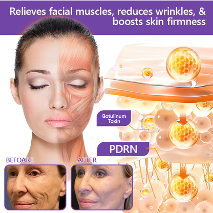 Enjoy an exclusive 30% discount: Yovot® PDRN Multi-Peptide Massaging Body Roller Cream- Anti-aging, Hydrating, Skin Firming & Lifting, Skin Repair, Even Tone, Acne and Dark Spot Treatment, Wart and Mole Removal, and Psoriasis Relief