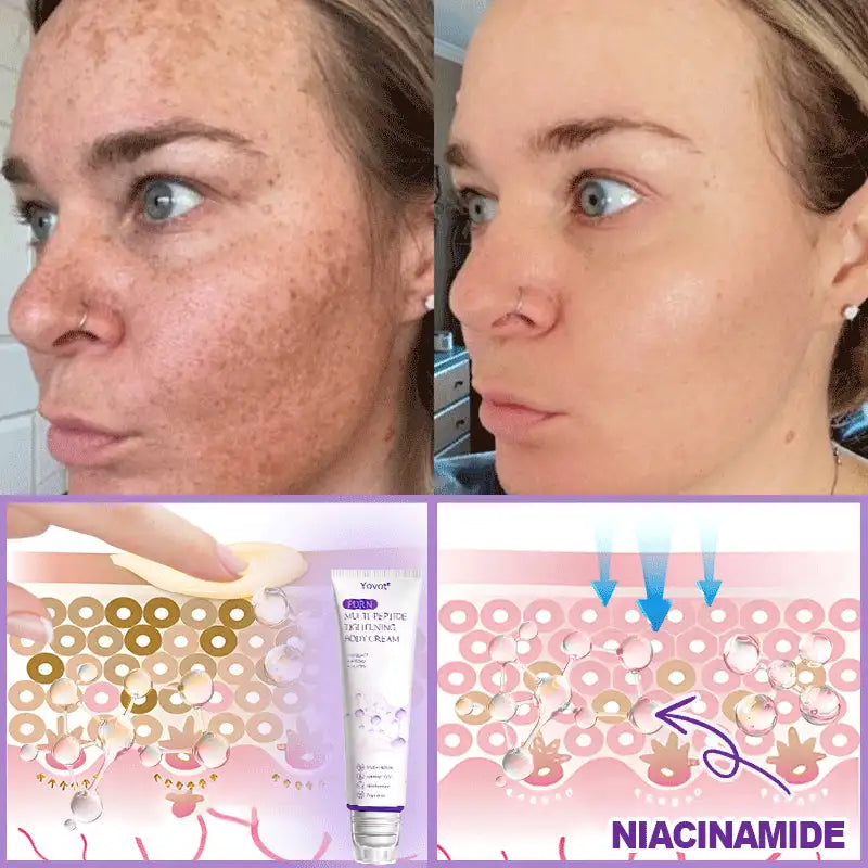 Enjoy an exclusive 30% discount: Yovot® PDRN Multi-Peptide Massaging Body Roller Cream- Anti-aging, Hydrating, Skin Firming & Lifting, Skin Repair, Even Tone, Acne and Dark Spot Treatment, Wart and Mole Removal, and Psoriasis Relief