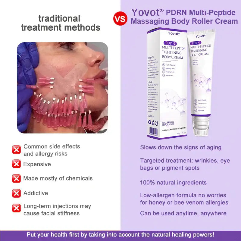 Enjoy an exclusive 30% discount: Yovot® PDRN Multi-Peptide Massaging Body Roller Cream- Anti-aging, Hydrating, Skin Firming & Lifting, Skin Repair, Even Tone, Acne and Dark Spot Treatment, Wart and Mole Removal, and Psoriasis Relief
