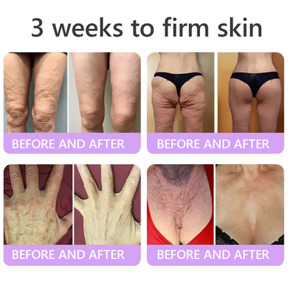 Enjoy an exclusive 30% discount: Yovot® PDRN Multi-Peptide Massaging Body Roller Cream- Anti-aging, Hydrating, Skin Firming & Lifting, Skin Repair, Even Tone, Acne and Dark Spot Treatment, Wart and Mole Removal, and Psoriasis Relief