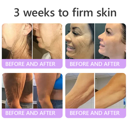 Enjoy an exclusive 30% discount: Yovot® PDRN Multi-Peptide Massaging Body Roller Cream- Anti-aging, Hydrating, Skin Firming & Lifting, Skin Repair, Even Tone, Acne and Dark Spot Treatment, Wart and Mole Removal, and Psoriasis Relief
