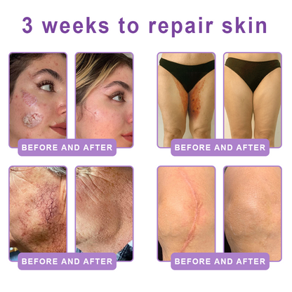 Enjoy an exclusive 30% discount: Yovot® PDRN Multi-Peptide Massaging Body Roller Cream- Anti-aging, Hydrating, Skin Firming & Lifting, Skin Repair, Even Tone, Acne and Dark Spot Treatment, Wart and Mole Removal, and Psoriasis Relief