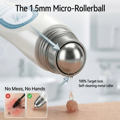 Yovot®🩹🎉7-𝐷𝑎𝑦 𝗧𝐚𝐠 & 𝗦𝗽𝐨𝐭 𝐄𝐫𝒂𝒔𝒆𝒓(Zero Pain, Zero 𝐒𝐜𝐚𝒓𝒔 Rollerball)