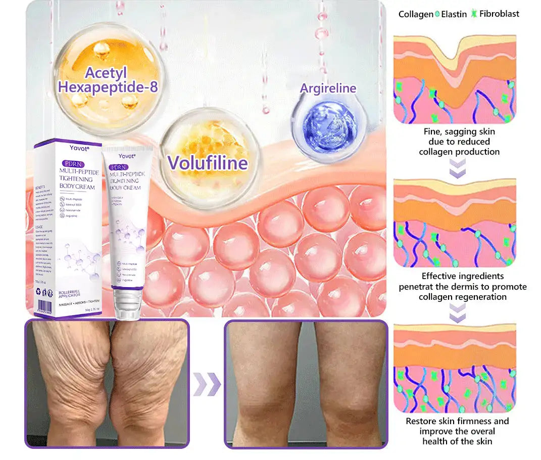Enjoy an exclusive 30% discount: Yovot® PDRN Multi-Peptide Massaging Body Roller Cream- Anti-aging, Hydrating, Skin Firming & Lifting, Skin Repair, Even Tone, Acne and Dark Spot Treatment, Wart and Mole Removal, and Psoriasis Relief
