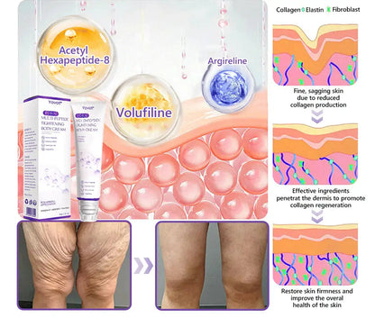 Enjoy an exclusive 30% discount: Yovot® PDRN Multi-Peptide Massaging Body Roller Cream- Anti-aging, Hydrating, Skin Firming & Lifting, Skin Repair, Even Tone, Acne and Dark Spot Treatment, Wart and Mole Removal, and Psoriasis Relief