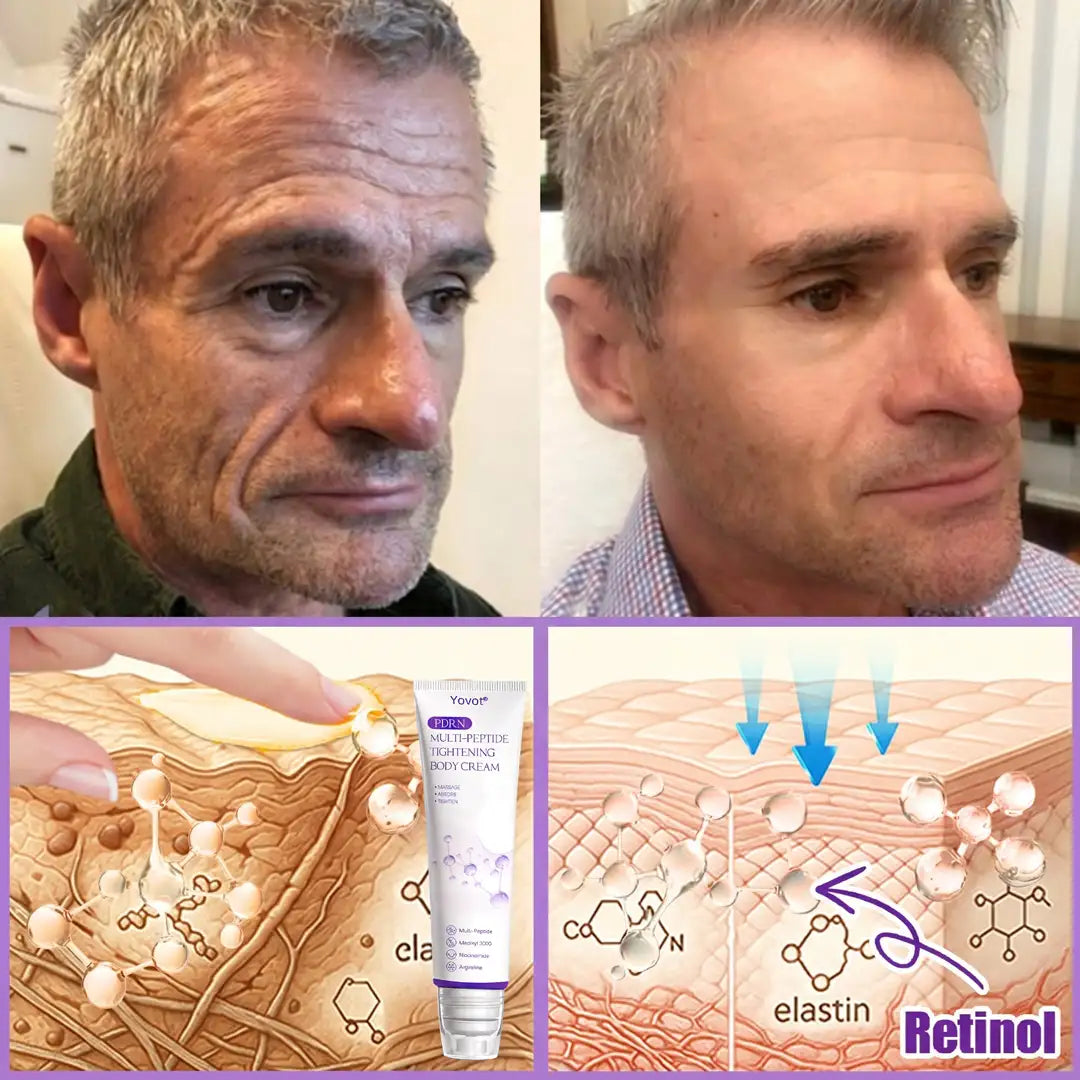 Enjoy an exclusive 30% discount: Yovot® PDRN Multi-Peptide Massaging Body Roller Cream- Anti-aging, Hydrating, Skin Firming & Lifting, Skin Repair, Even Tone, Acne and Dark Spot Treatment, Wart and Mole Removal, and Psoriasis Relief