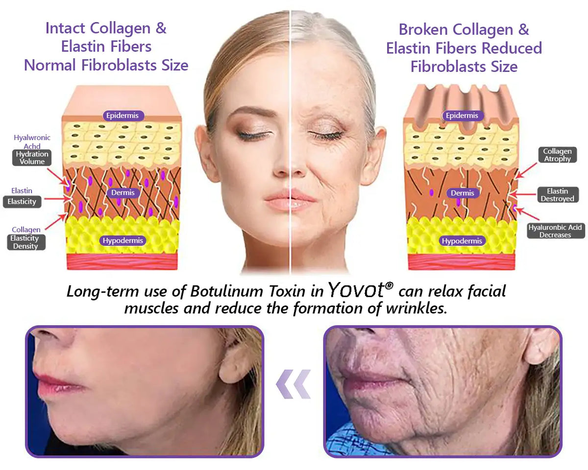 Enjoy an exclusive 30% discount: Yovot® PDRN Multi-Peptide Massaging Body Roller Cream- Anti-aging, Hydrating, Skin Firming & Lifting, Skin Repair, Even Tone, Acne and Dark Spot Treatment, Wart and Mole Removal, and Psoriasis Relief