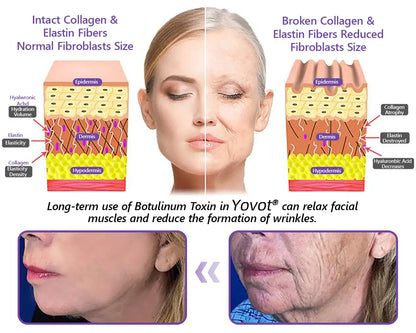 Enjoy an exclusive 30% discount: Yovot® PDRN Multi-Peptide Massaging Body Roller Cream- Anti-aging, Hydrating, Skin Firming & Lifting, Skin Repair, Even Tone, Acne and Dark Spot Treatment, Wart and Mole Removal, and Psoriasis Relief