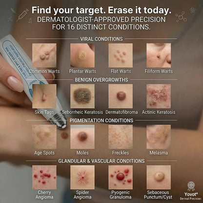 Yovot®🩹🎉7-𝐷𝑎𝑦 𝗧𝐚𝐠 & 𝗦𝗽𝐨𝐭 𝐄𝐫𝒂𝒔𝒆𝒓(Zero Pain, Zero 𝐒𝐜𝐚𝒓𝒔 Rollerball)